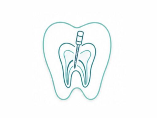 Endodontie / Wurzelbehandlung Endodontie / Wurzelbehandlung